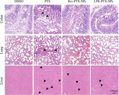 Self-assembled peptide-paclitaxel nanoparticles for enhancing therapeutic efficacy in colorectal cancer